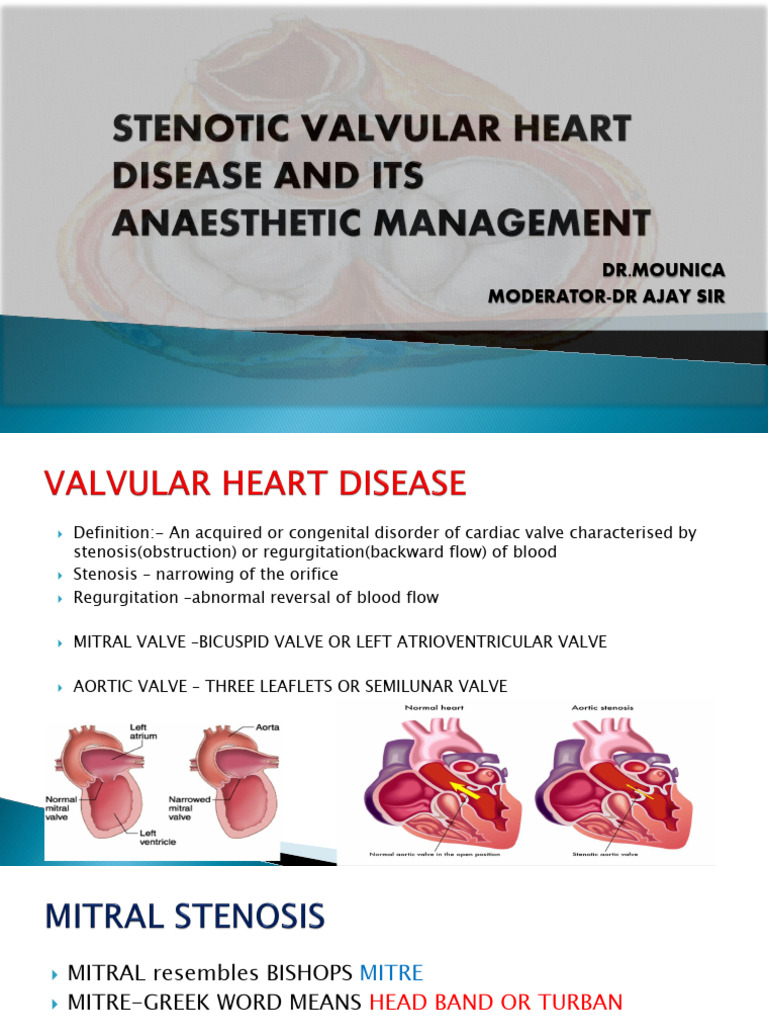 Mitral Valve Stenosis Overview and Management | PDF | Heart Valve | Heart