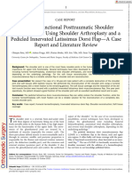 Orthopaedic Surgery - 2022 - Bota - Complex Functional Posttraumatic Shoulder Reconstruction Using Shoulder Arthroplasty