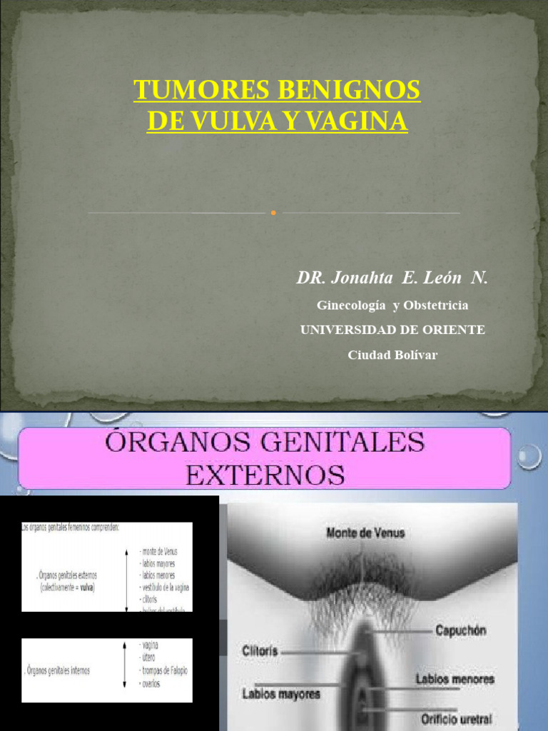 patolog-a-de-vulva-y-vagina-nuevo-recuperado-pdf-neoplasias-labios
