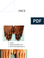 OSCE