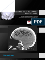 02 Imagenologia Ii - Lesiones Oseas Del Craneo