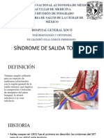 Sindrome de Compresión Toracica