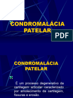 Condromalácia Patelar