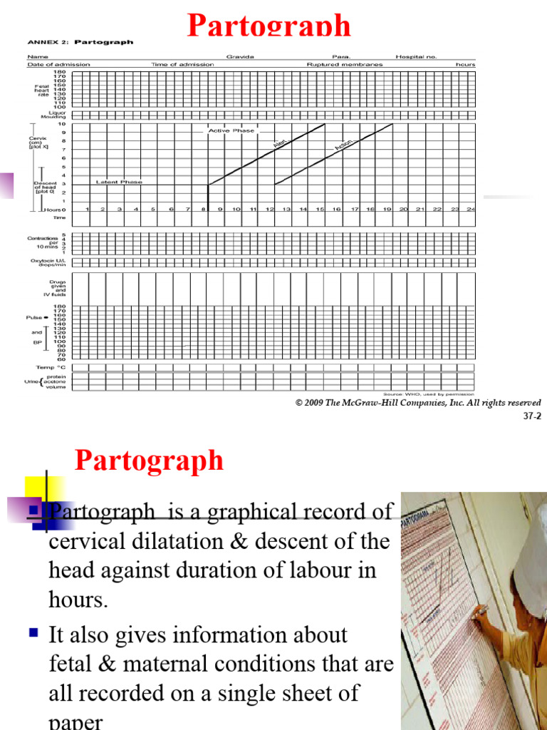 P Artograph | PDF | Childbirth | Clinical Medicine