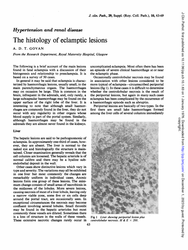 eclampsia-pdf-animal-anatomy-medical-specialties