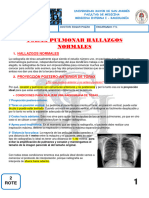 Radiologia Torax Normal y Patologica