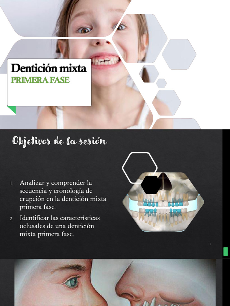 Dentición Mixta 1 Fase - Se2 2020-1 3 | PDF | Anatomia dental | Diente