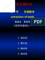 Extraction of Teeth