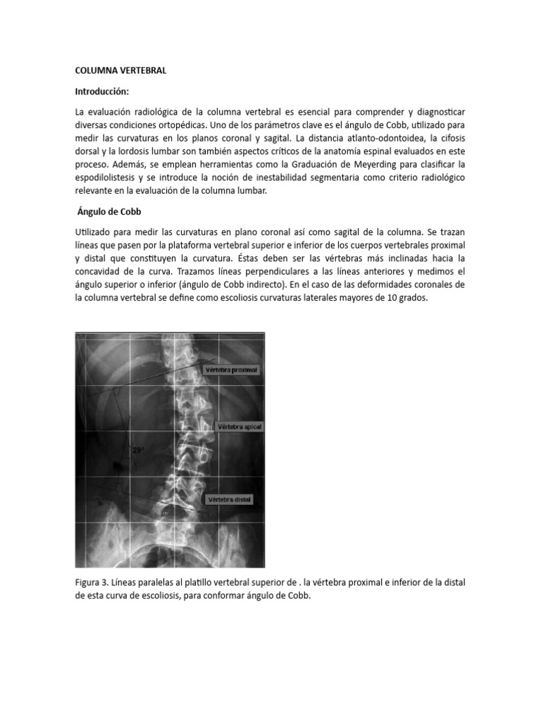 Columna Vertebral 1 Pdf La Columna Vertebral Escoliosis