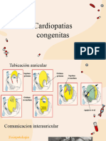 Cardiopatia Hipertrofica