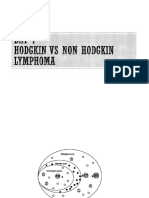 Hodgkin Vs Non Hodgkin