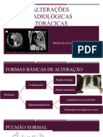 4 Alterações Raiológicas Torácicas