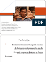 Polidactiliafinal 130423152852 Phpapp01 PDF