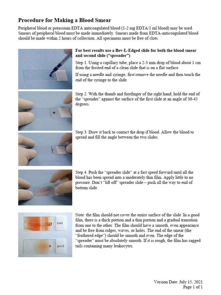Blood Smear Preparation Guide | PDF
