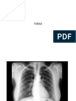 Tema 5. Tórax