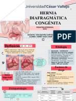 Hernia Diafragmática Congénita-Correa Yanac Angie