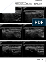 Ultrassom Cotovelo