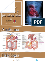 Obstruccion y Seudoobstruccion Intestinal