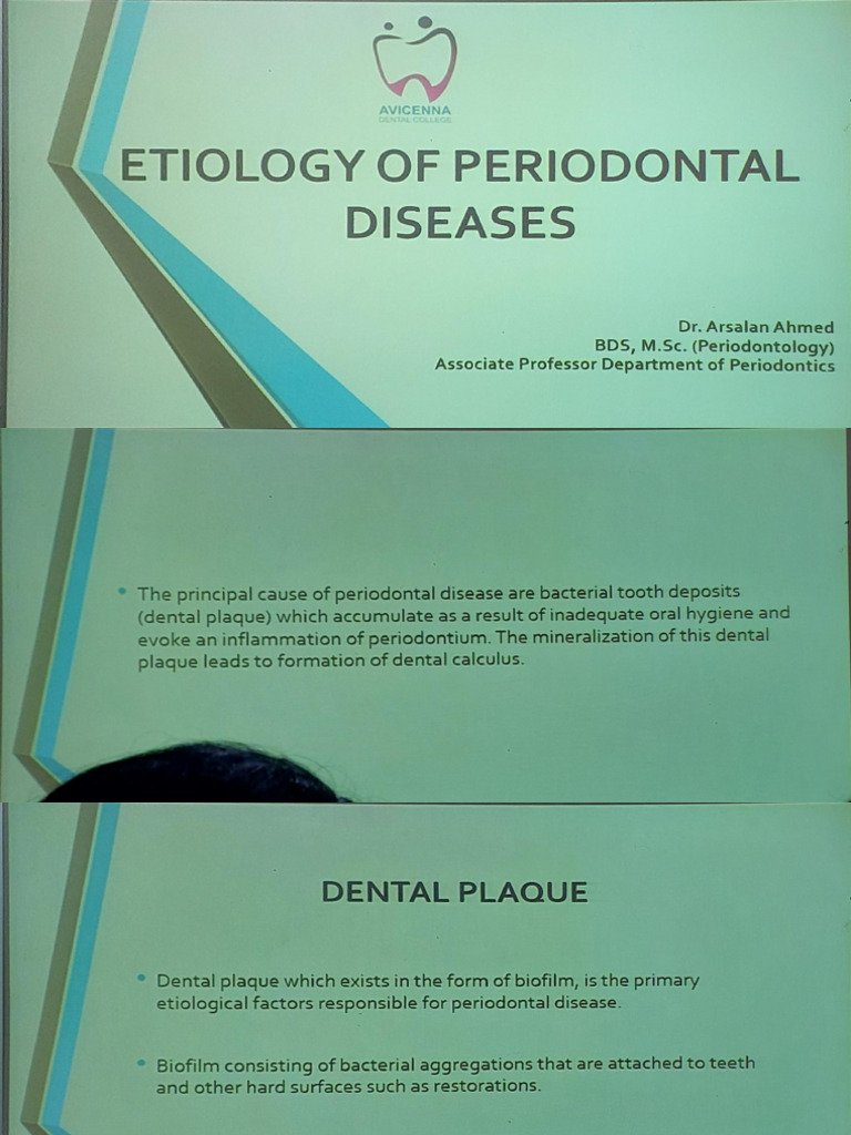 Etiology of periodontal disease pdf
