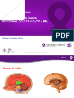 Anatomia Radiológica Seccional Do Crânio TC e RM Silva Inca