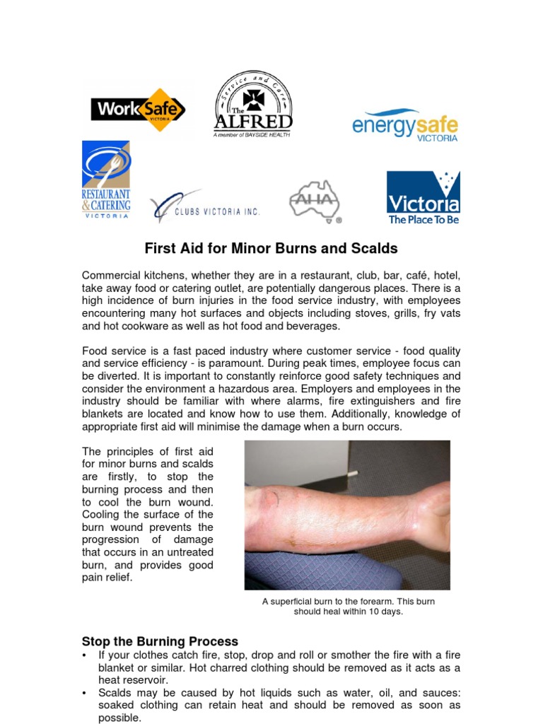 First Aid for Minor Burns and Scalds Stop the Burning Process Burn