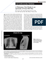 dahiya-et-al-2013-aorta-to-pulmonary-vein-fistula-in-an-asymptomatic-25-year-old-man