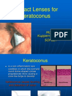 Contact Lenses For Keratoconus: Moodi Kupperman B.SC Soflex