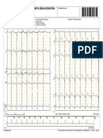 Angga Dermawan - Pt. Permata Graha Nusantara Ecg