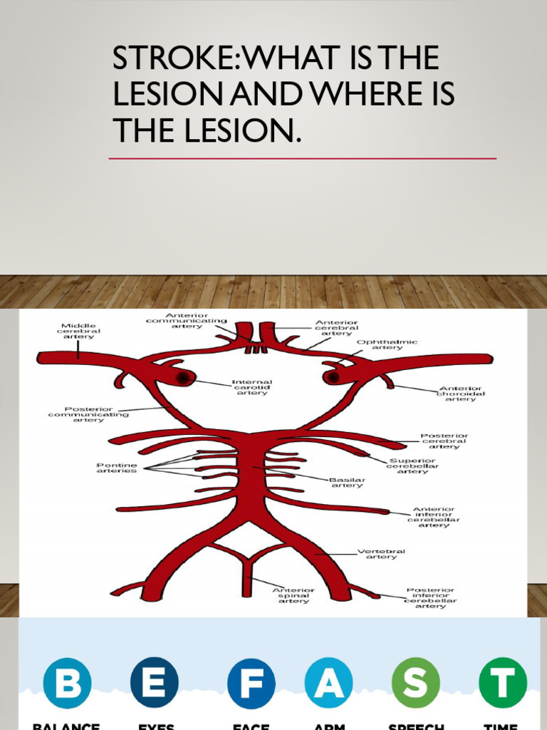 Stroke & DM Notes | PDF | Brainstem | Neuroscience