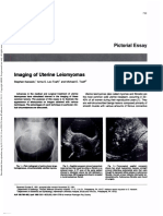 Karasick Et Al 2013 Imaging of Uterine Leiomyomas