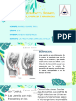 Uretritis, Prost Wps Office