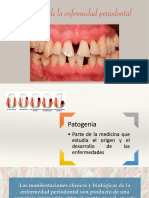 Patogenia de La Enfermedad Periodontal