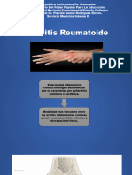 Artriris Reumatoide