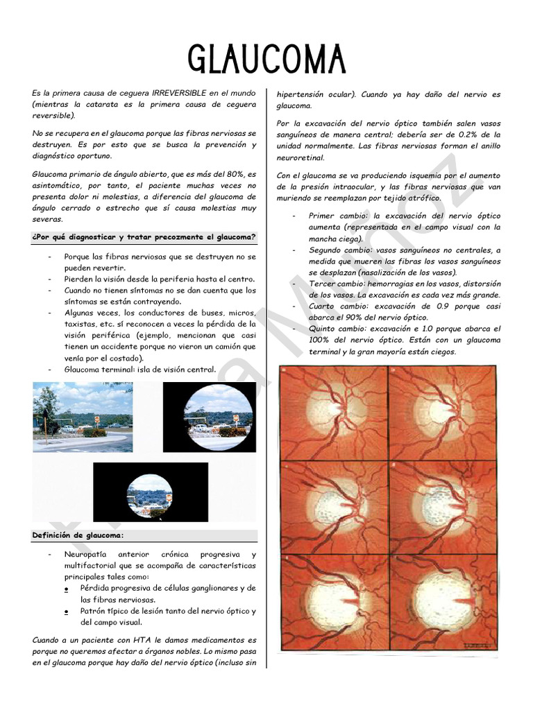 Diferencias entre glaucomas y diagnóstico | PDF | Glaucoma | Ojo humano