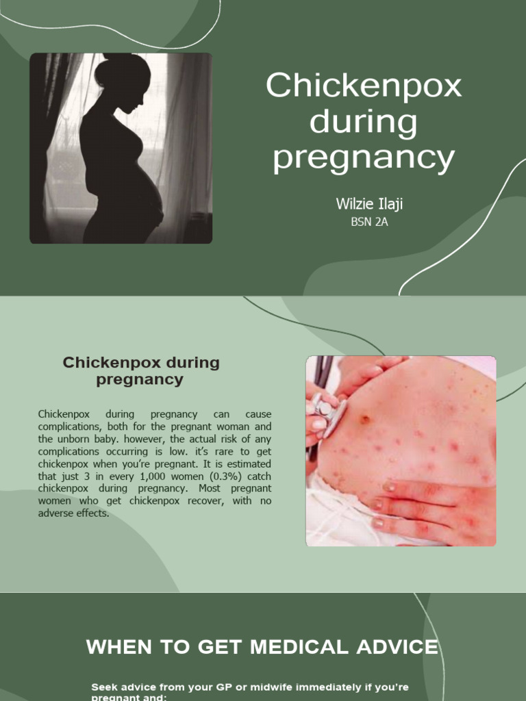 Chickenpox In Pregnancy Gp Notebook