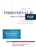 Fibromiyalji