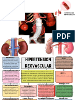 Hipertensión RENAL