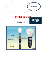 Dental Implant 5