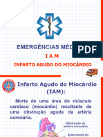 2) Infarto Agudo Do Miocárdio (Iam)