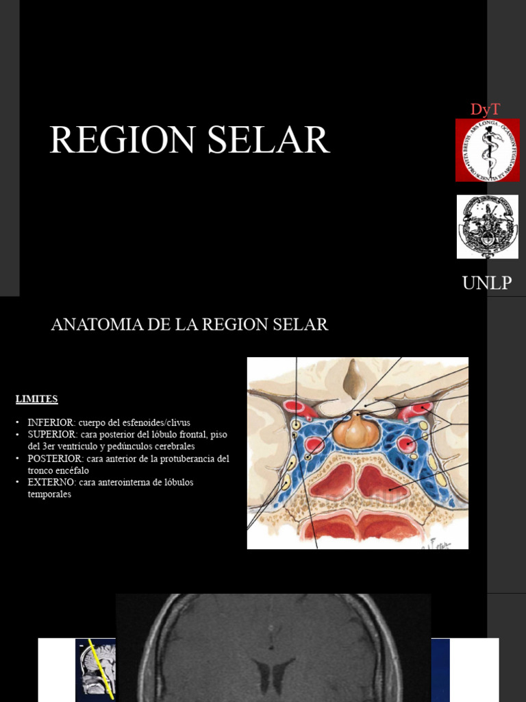 Anatomía y Patologías de la Región Selar | PDF | Glándula pituitaria ...
