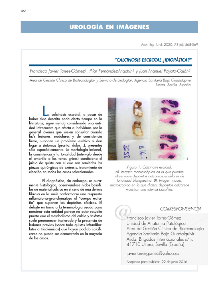 Calcinosis Escrotal: Diagnóstico y Tratamiento | PDF | Biología ...
