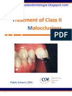 Treatment of Class II Malocclusions - Pablo Echarri