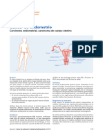 Cancer de Endometrio