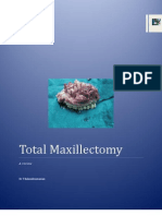 Maxillectomy a Review