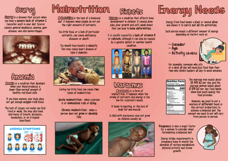 Understanding Malnutrition and Its Effects | PDF