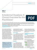 Ectodermal Dysplasia A