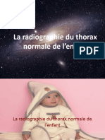 Radiographie Du Thorax Normale de L - Enfant