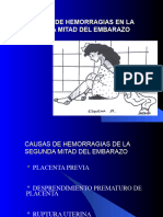 10m-Causas de Hemorragias en La Segunda Mitad Del Embarazo