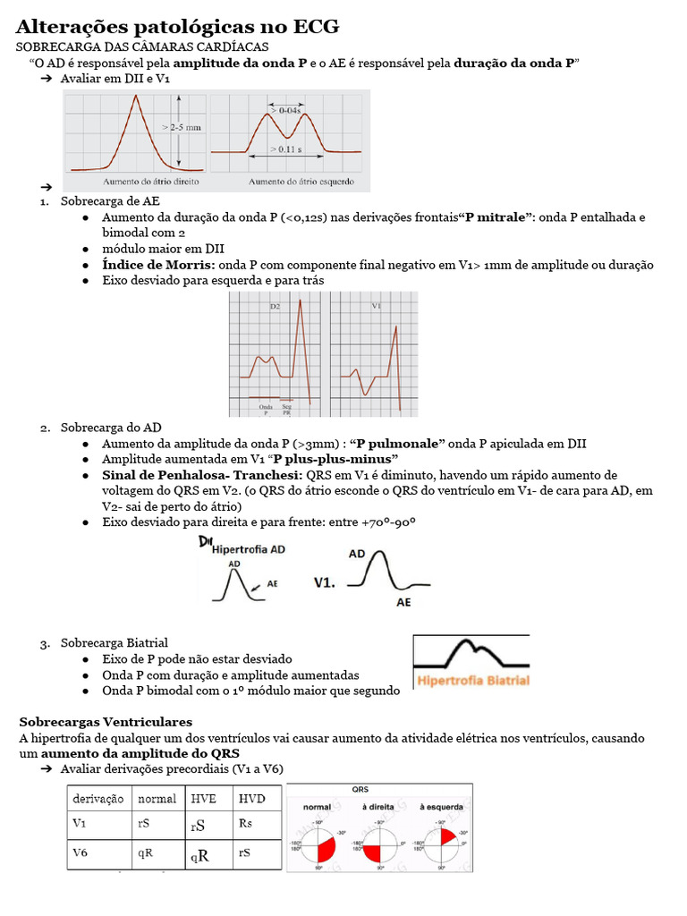 Resumo da Síndrome de Wellens: classificação e mais!, image size:768x1024