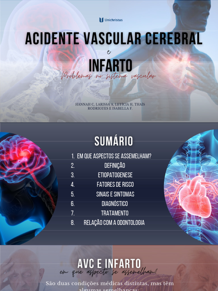 AVC: Causas, Sintomas e Tratamento | PDF | AVC | Infarto do Miocárdio